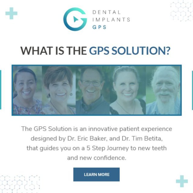 Dental Implants GPS