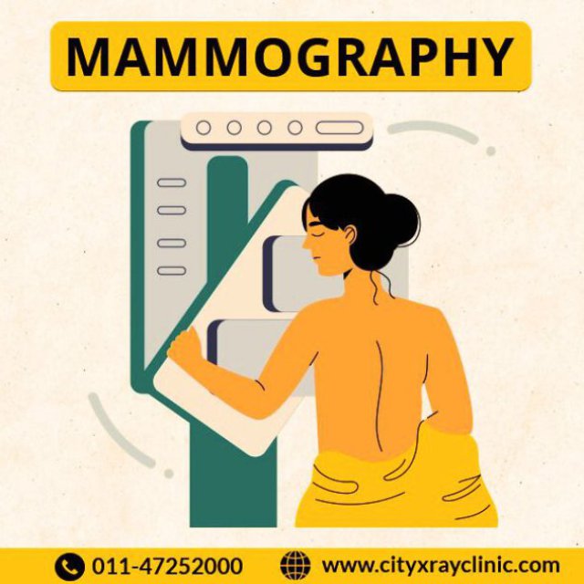 Best Mammography Scan Near Me in Delhi NCR