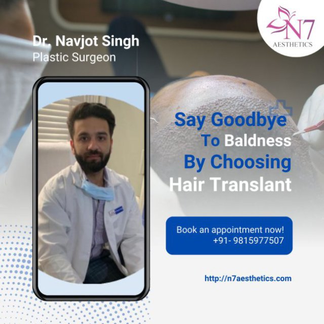 Hair Transplant in Mohali - N7aesthetics