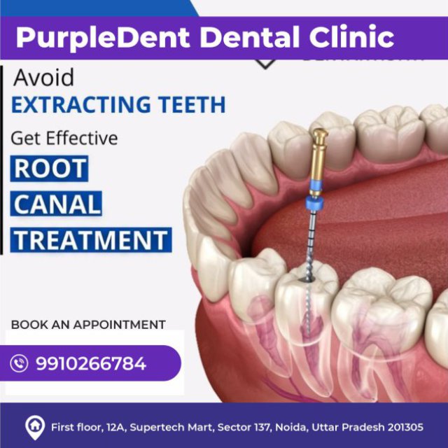 Dental Clinic Noida Sector 137