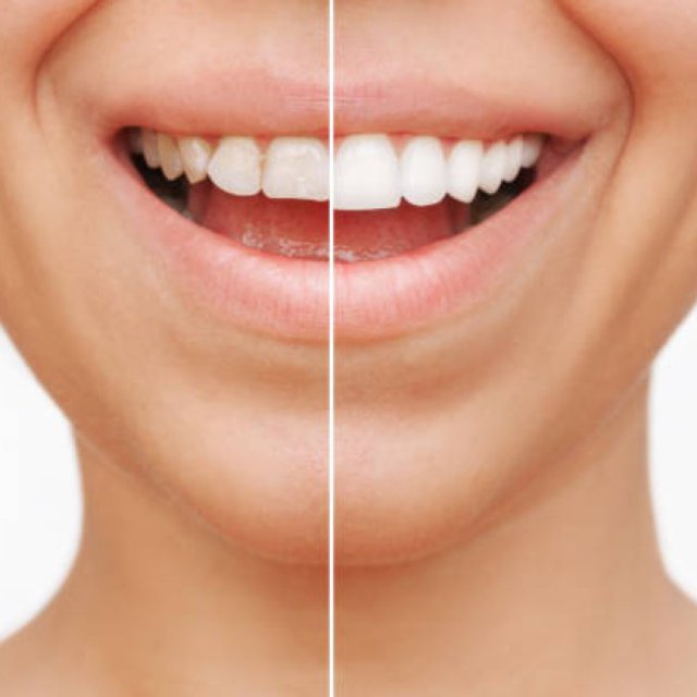 Wedentist dental clinic in coimbatore