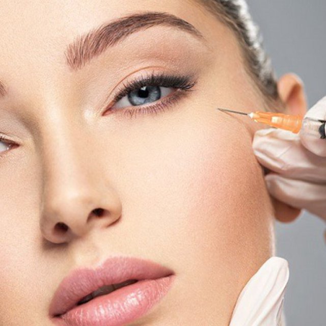Radiesse Fillers Injections In Dubai