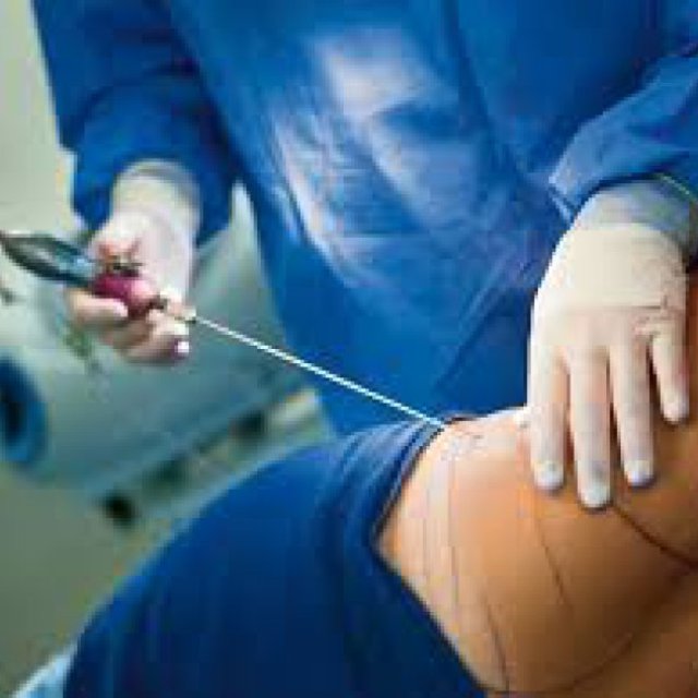 Intimate Surgery in Dubai