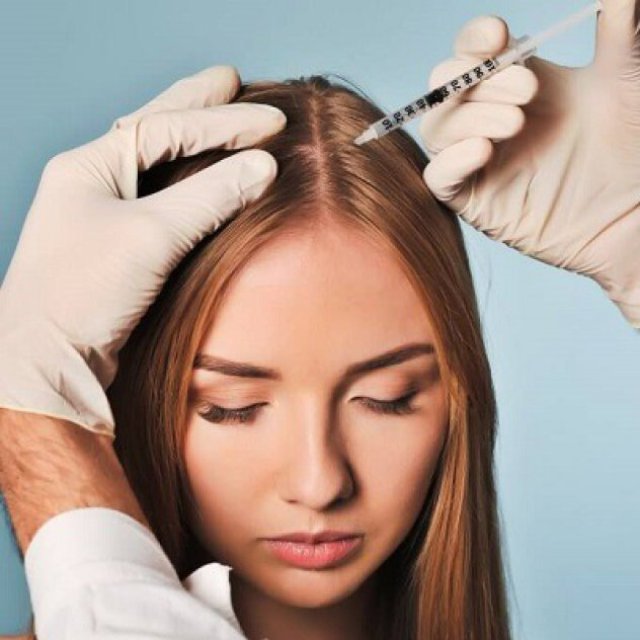 Hair Transplant Specialists in Dubai