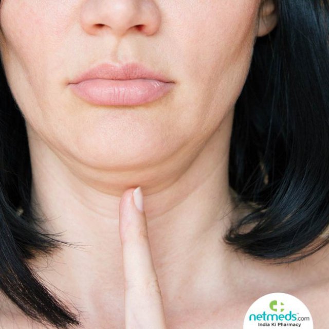 Double Chin Removal: Causes, Prevention, Treatment