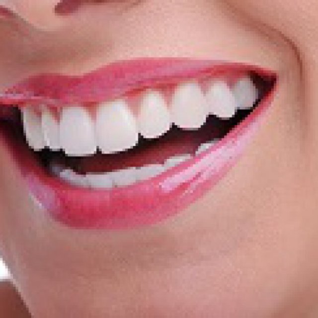 Best Teeth Whitening in Brighton East - BEDC