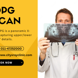 OPG X-Ray Near Me: Find Nearby Dental Imaging