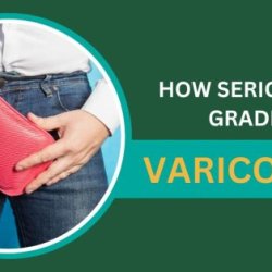 Varicocele treatment without surgery