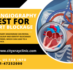 CT Coronary Scan Price Key Insights