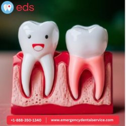 24 Hour Dentist in Killeen XXXXX - Emergency Dental Service