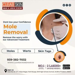 Clear Skin Hair & Laser Centre