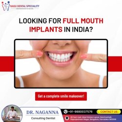 Nagu Dental Speciality | Dental Clinic In Bangalore