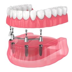 Smithville  Dental