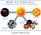 Stem Cell Therapy In Dallas