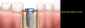 Smile Design Specialists