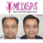 Medispa Hair Transplant Centre